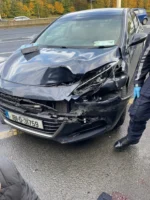 Acidente – Na Irlanda carro da polícia atropela brasileiro que tem a perna amputada